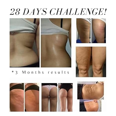 HIDRASTRIK® - ACEITE ANTIESTRÍAS