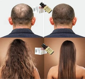 ANTERA - TONICO CAPILAR